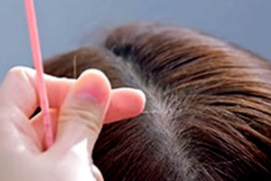 step03 Hair Plus PINPOINT Experience