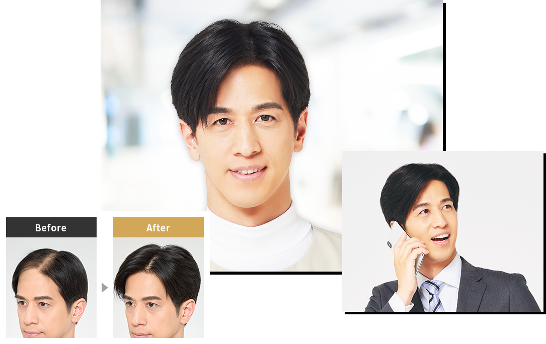 使用Hair Plus PINPOINT by Aderans