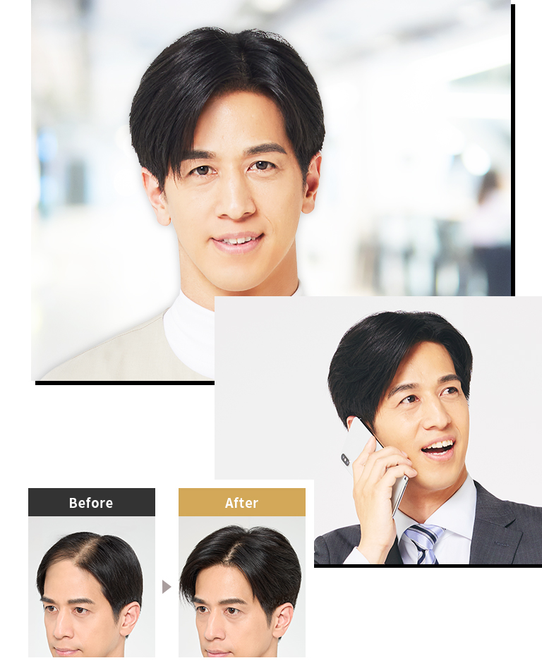 使用Hair Plus PINPOINT by Aderans