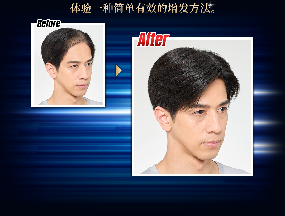 技术利用您现有的头发来增加发量