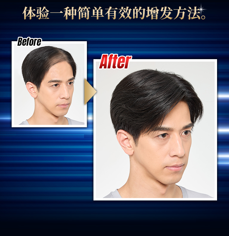 技术利用您现有的头发来增加发量