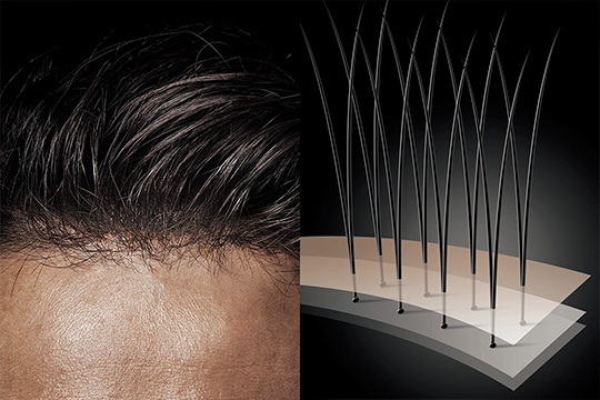 Don't let your hair concerns hold you back.