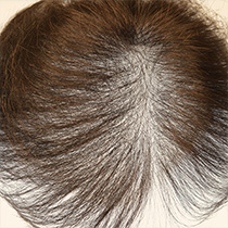 可拆卸式 可拆卸的类型，如戴 stopper等