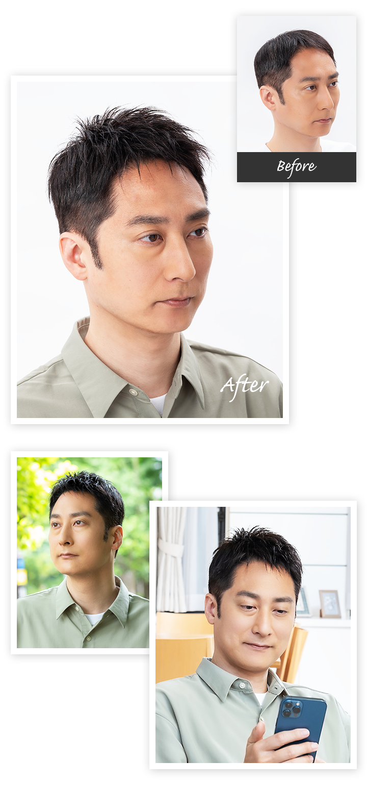 Aderans 假发 個案3