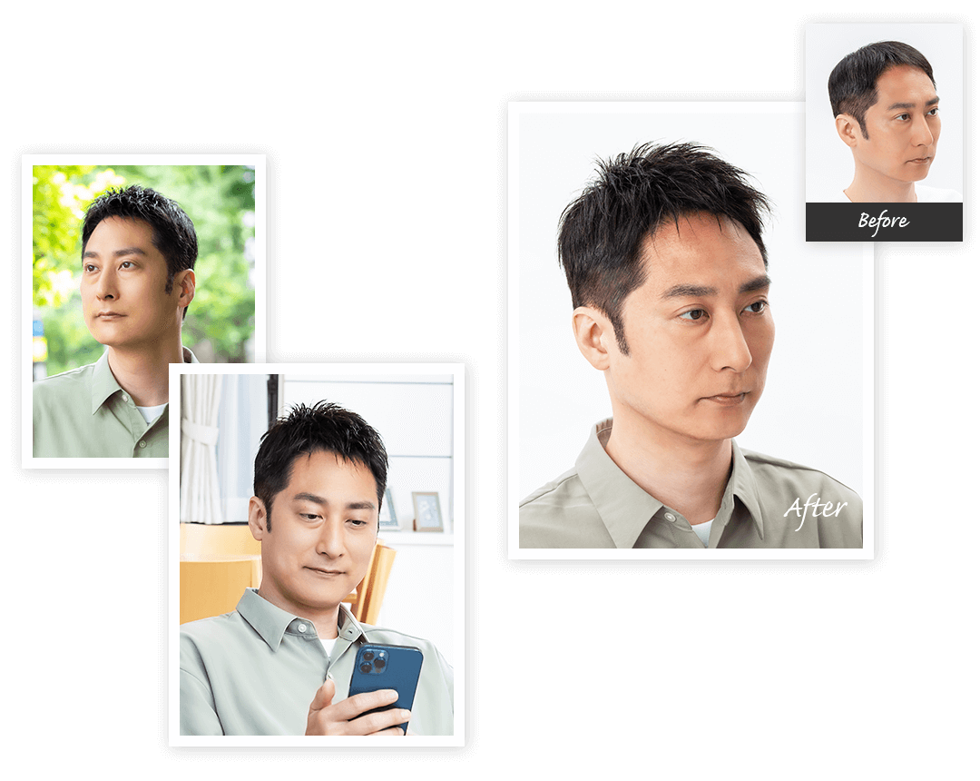 Aderans 假发 個案3