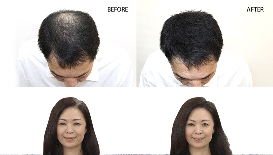 HairPlus SpeedE Premium Befor&After